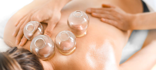 Cupping